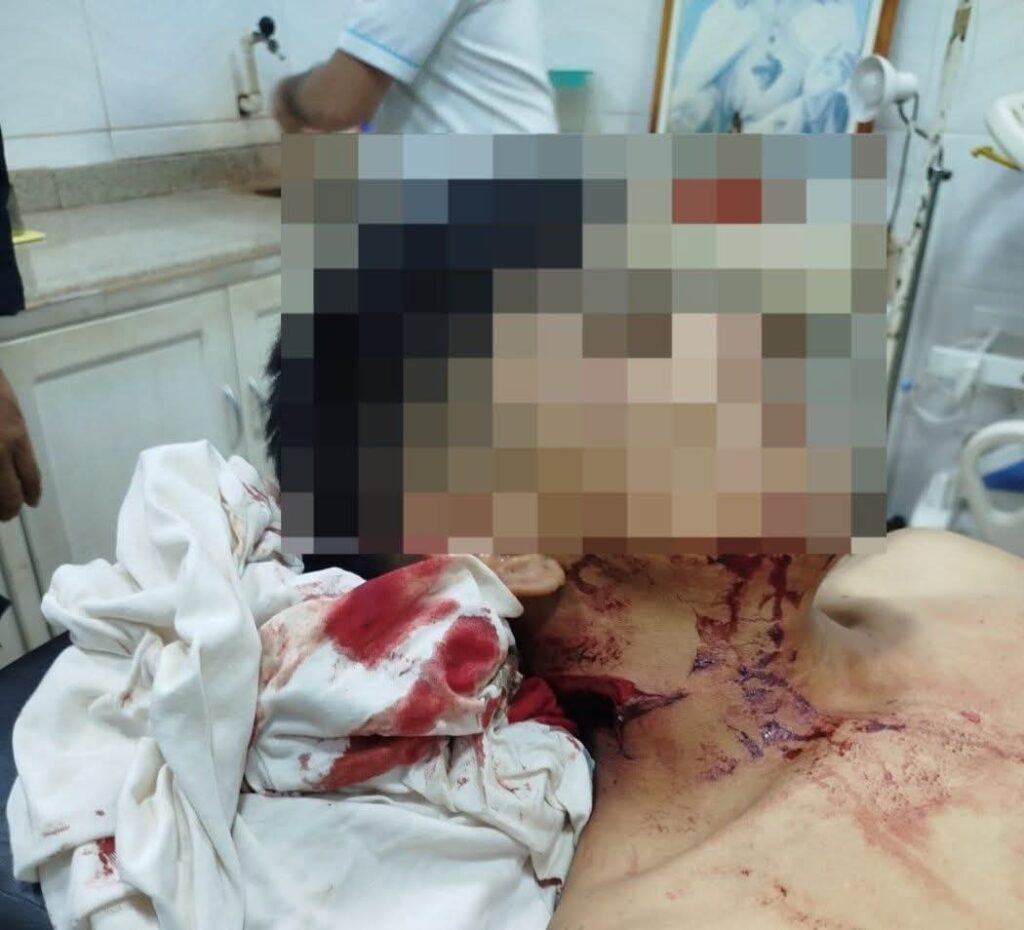 Pelea sangrienta en Horqueta.En Pleno Martes Santo, dos jóvenes fueron los protagonistas de este lamentable suceso.La víctima presentaba una herida en el cuello, producto de un corte producido por un arma blanca.Aquí detalles 👇