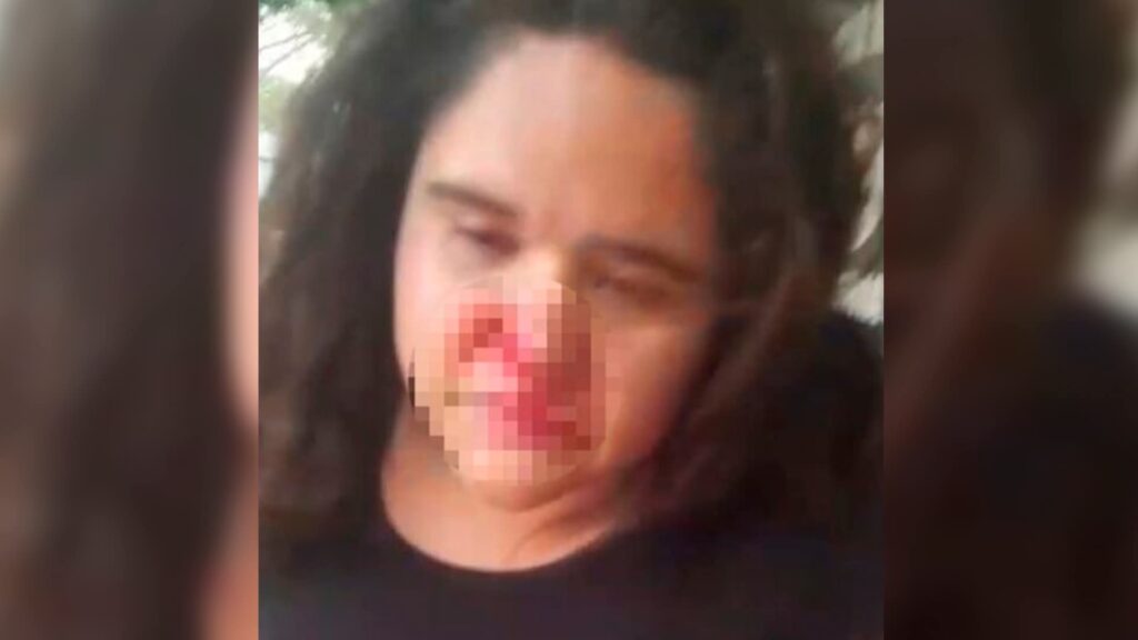 NIÑERA DENUNCIA QUE SU EXPATRONA LE ROMPIÓ LA NARIZ Y LE QUITÓ SU CELULAR  Una joven de 22 años denunció haber sido víctima de una violenta agresión por parte de su expatrona en Villa Hayes,