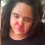 NIÑERA DENUNCIA QUE SU EXPATRONA LE ROMPIÓ LA NARIZ Y LE QUITÓ SU CELULAR  Una joven de 22 años denunció haber sido víctima de una violenta agresión por parte de su expatrona en Villa Hayes,